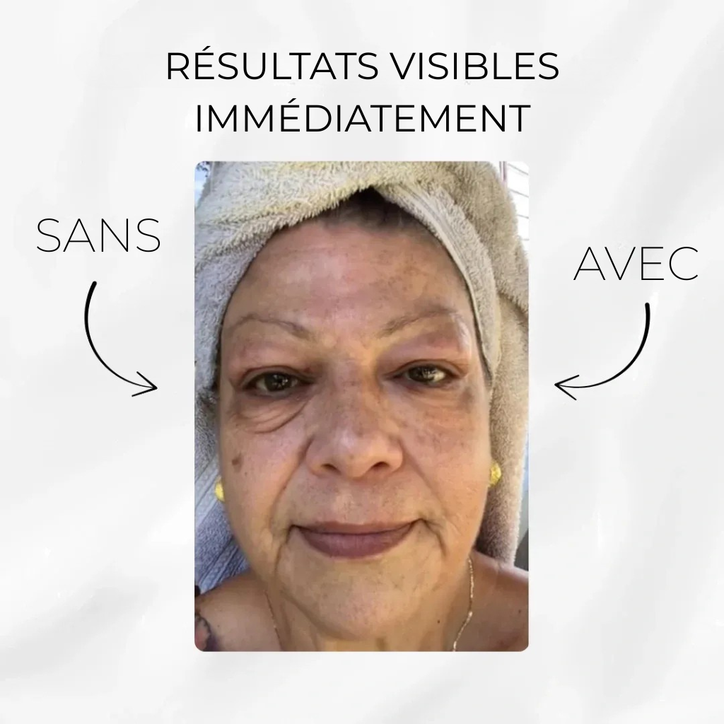 V-Lift™ – Soin Regard Sublime